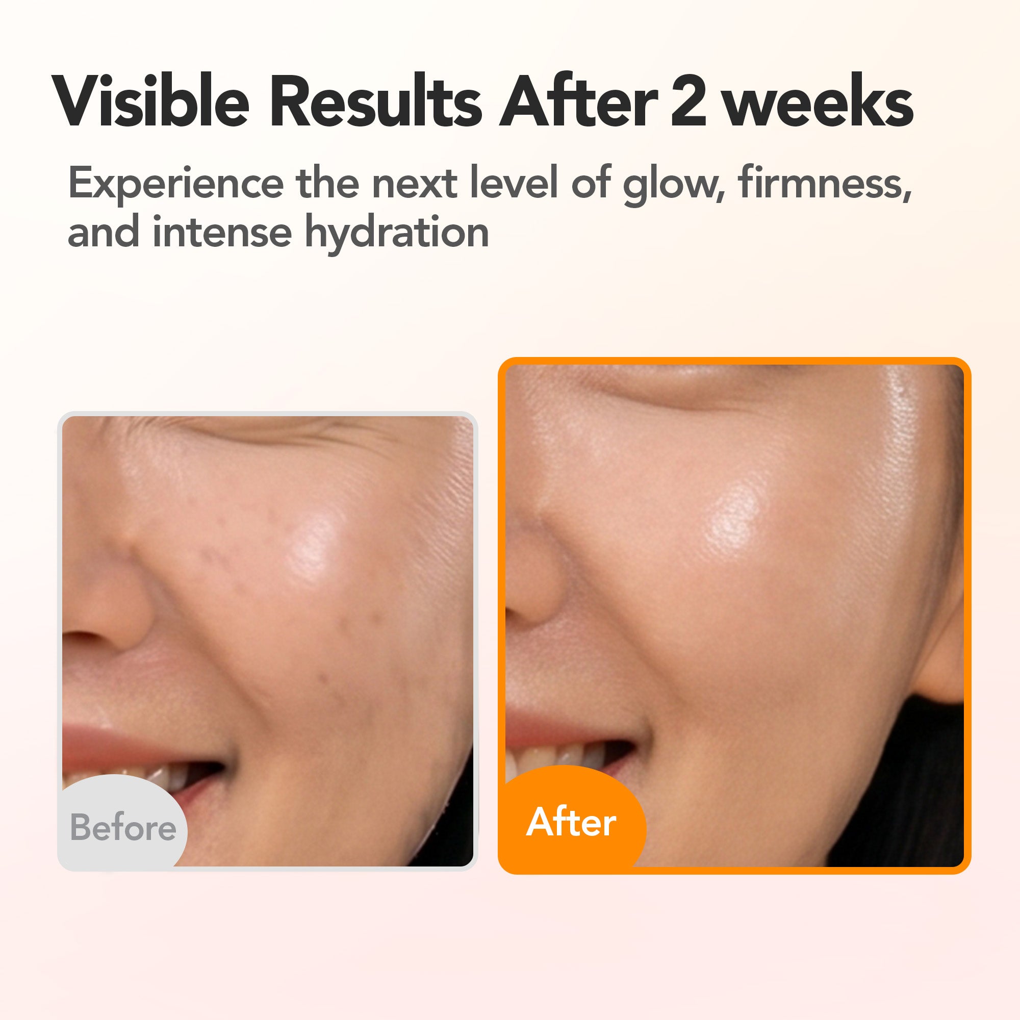 Before and after comparison of skin treatment showing visible results after 2 weeks.