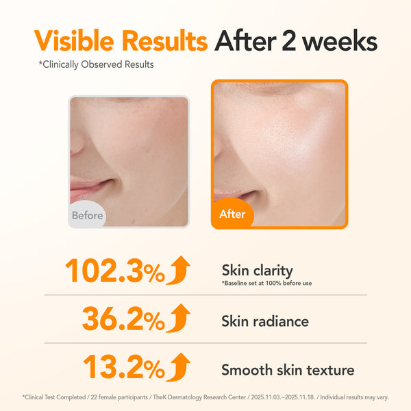 Before and after skin clarity improvement with visible results after 2 weeks on a beige background.