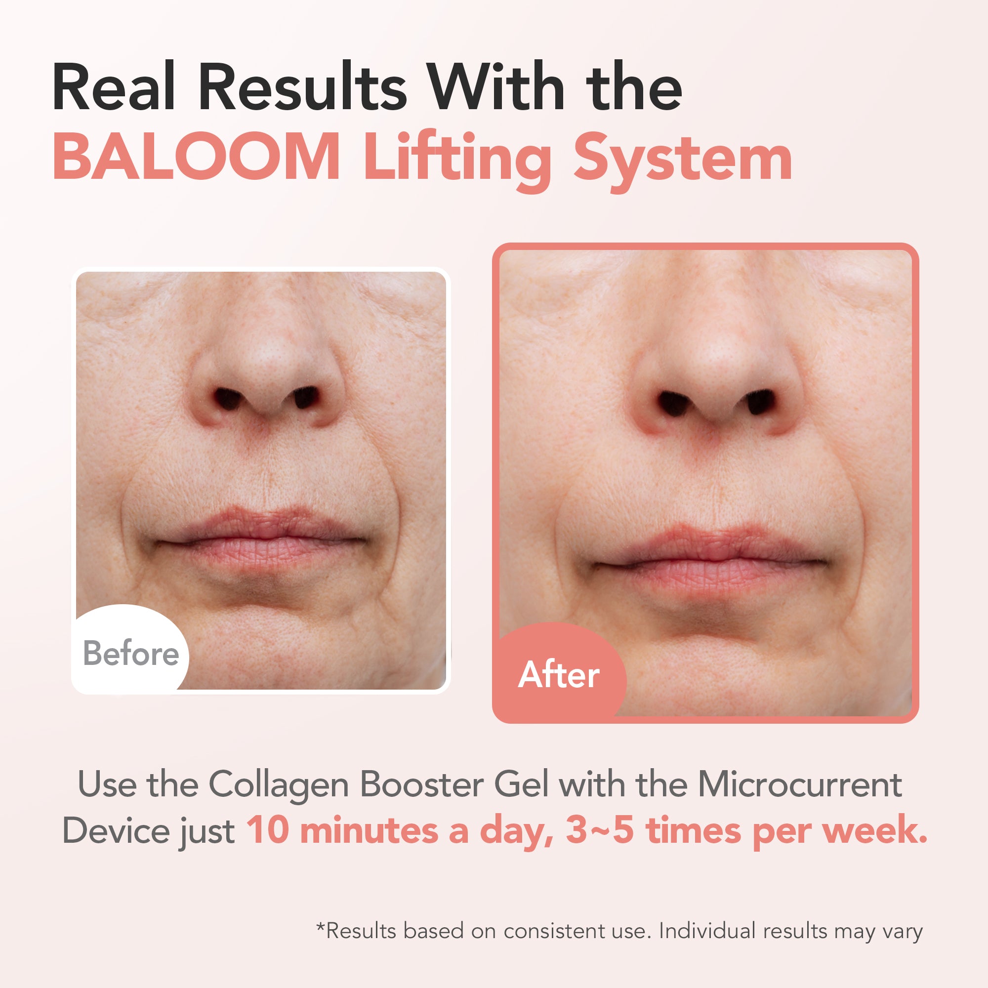 Before and after comparison of facial skin using the BALOOM Lifting System with text about usage instructions.